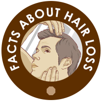Facts About Hair Loss