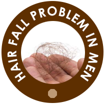 Hair fall problem in men