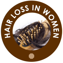 Hair Loss in Women