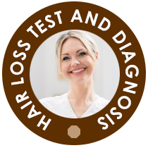 Hair Loss Test And Diagnosis