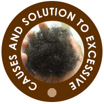 Causes And Solution To Excessive Hair Shedding 
