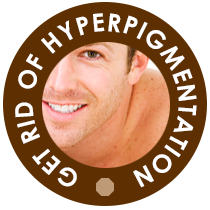 Get Rid of Hyper-pigmentation