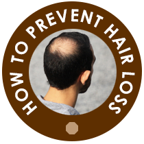 Prevent Hair Loss