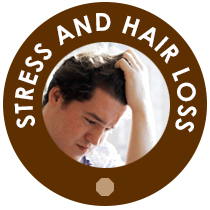 Stress and Hair Loss